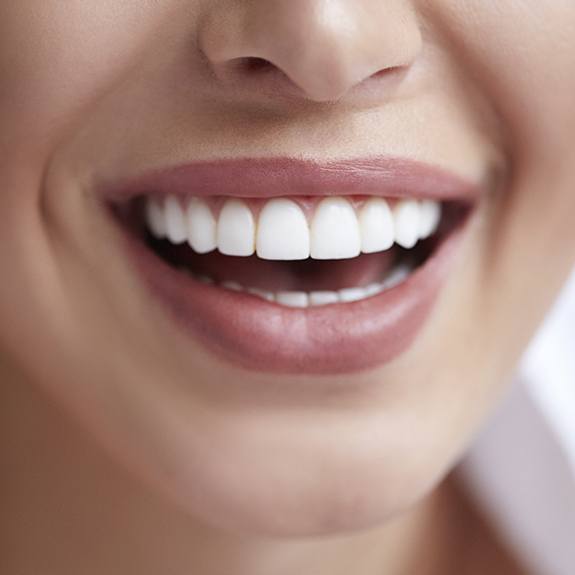 Smile with metal-free dental crowns