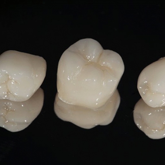 three dental crowns against black background