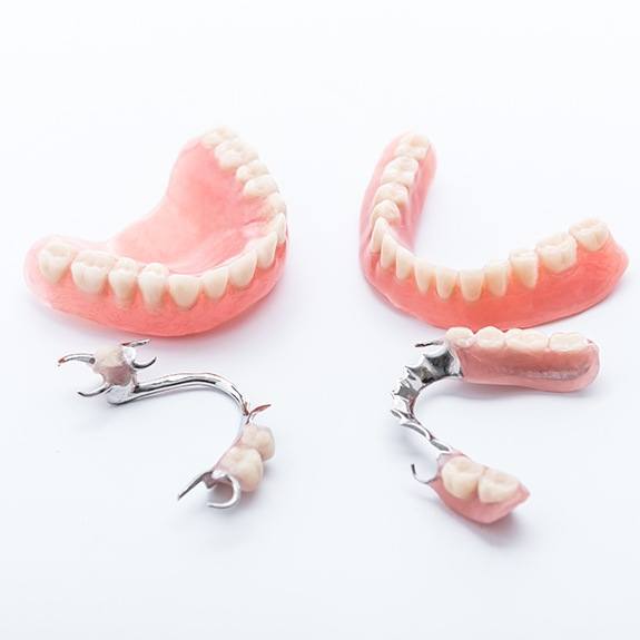 Four types of dentures