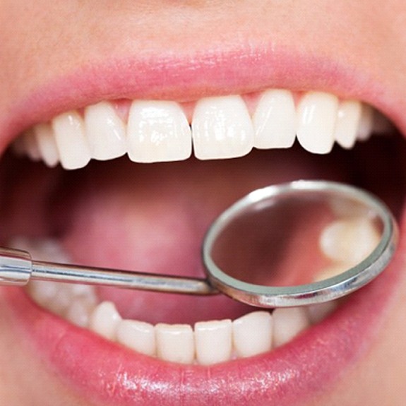 close up of a patient’s mouth with a dental mirror