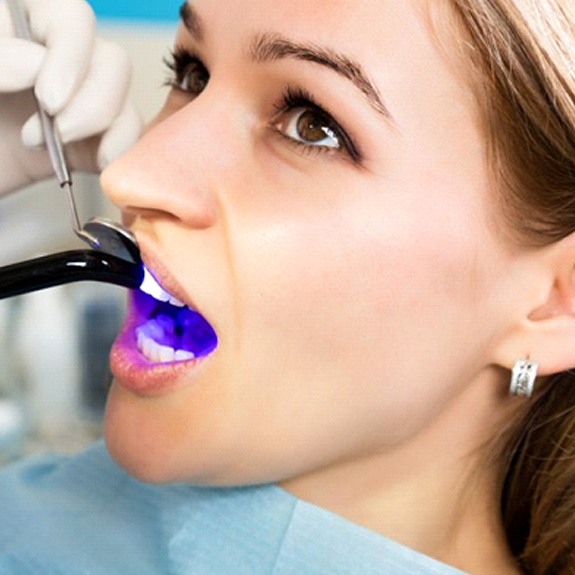 woman getting a tooth-colored filling
